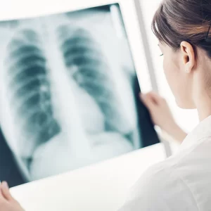 PNEUMOLOGIA 720X720 copia